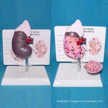 Human Kidney Medical Anatomic Model for Teaching (R110104)